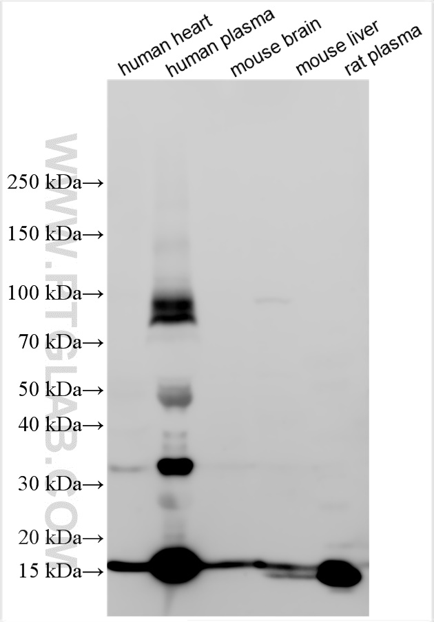 WB analysis using 31130-1-AP