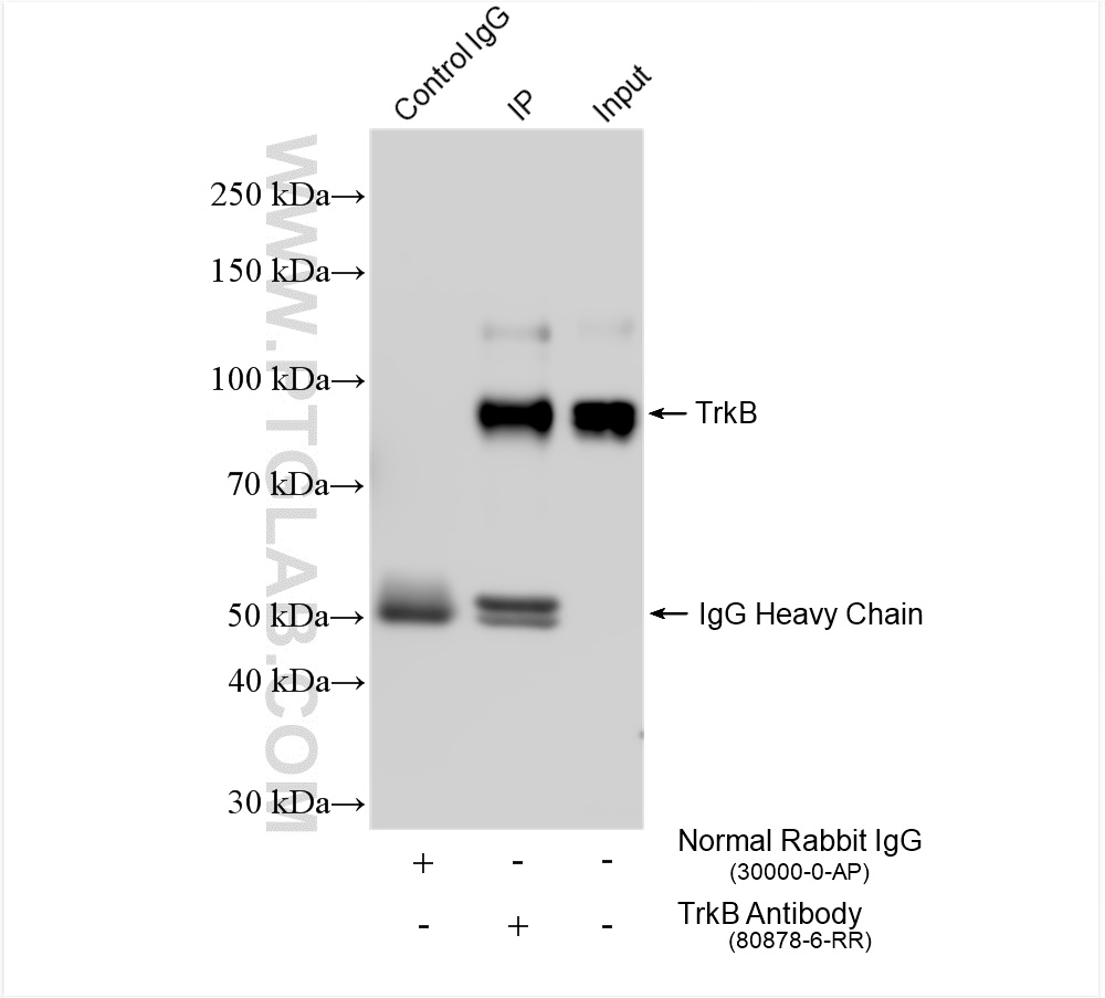 IP experiment of mouse cerebellum using 80878-6-RR