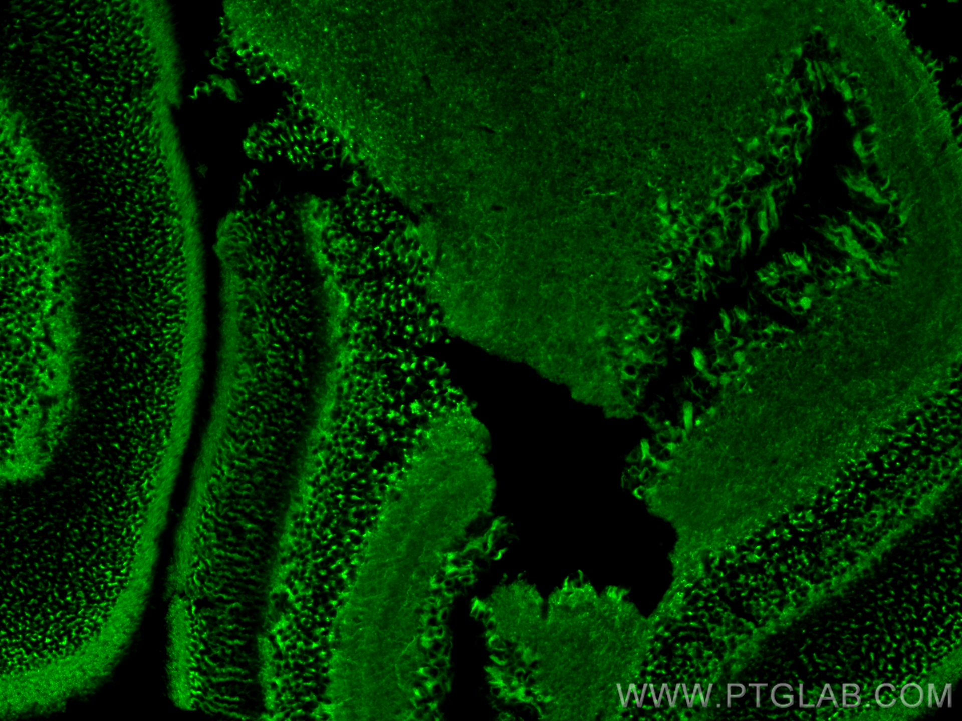 IF Staining of mouse eye using 66240-1-Ig