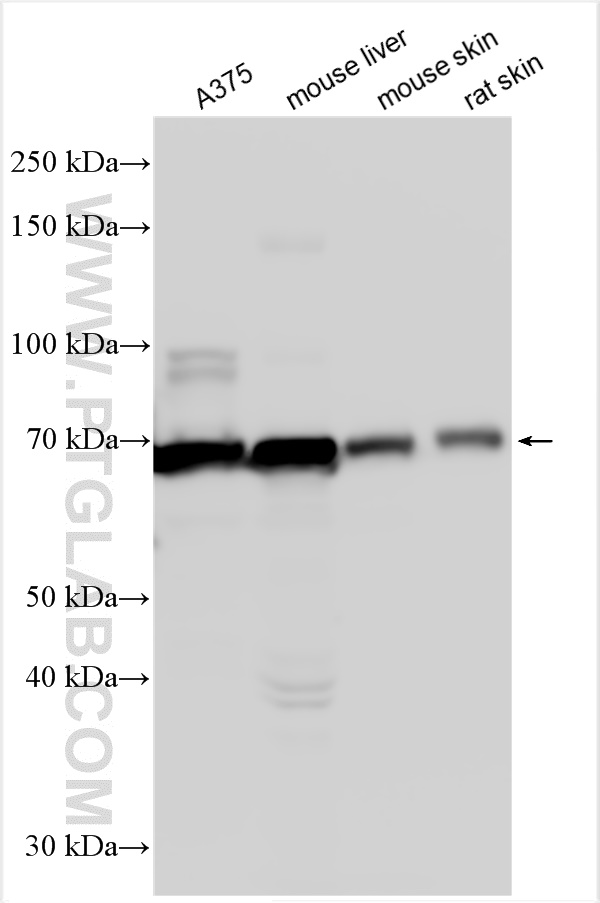 Tyrosinase