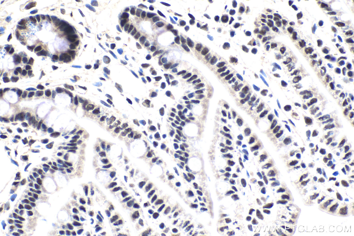 IHC staining of mouse small intestine using 10334-1-AP