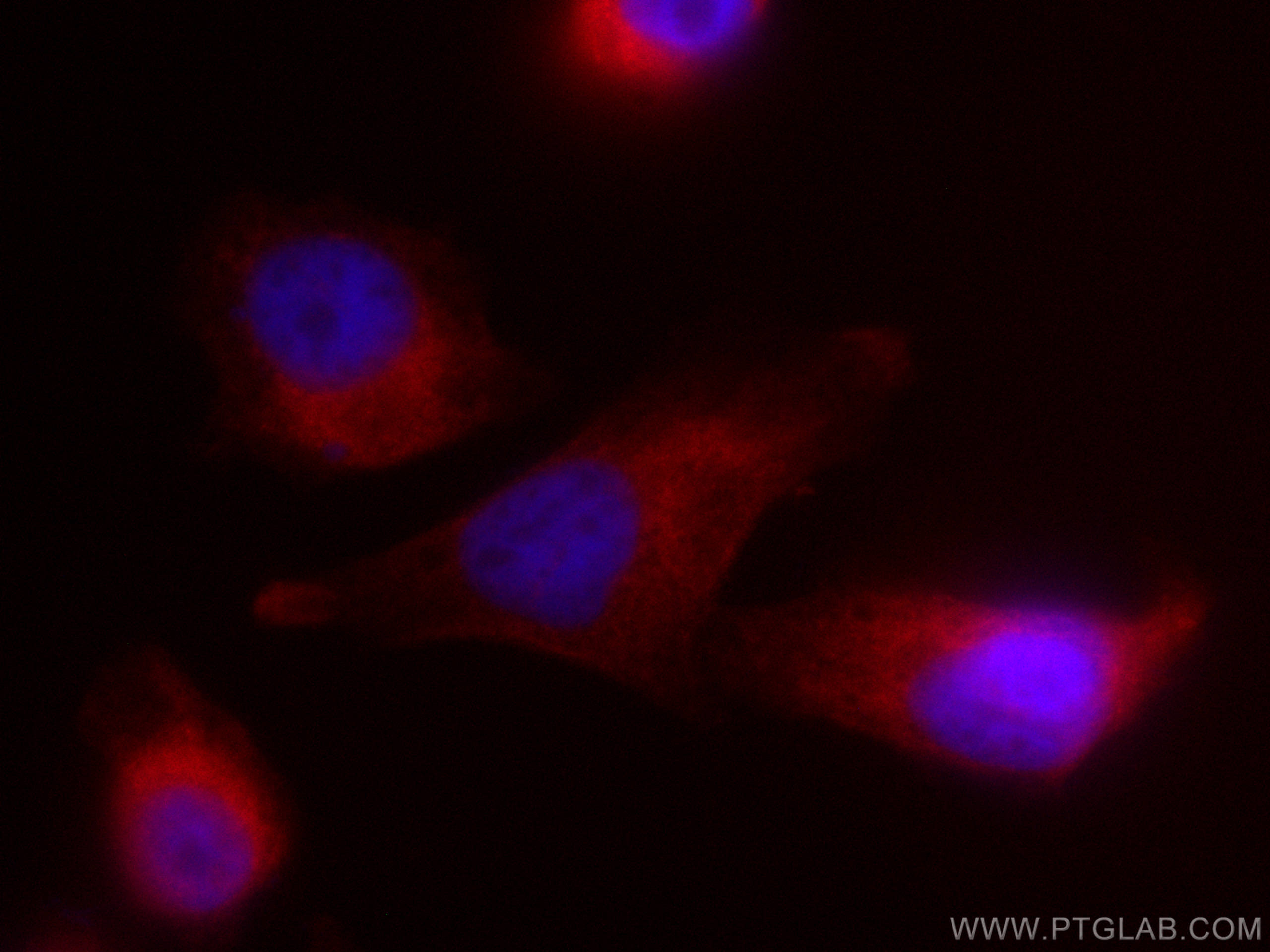 IF Staining of PC-3 using CL594-67545