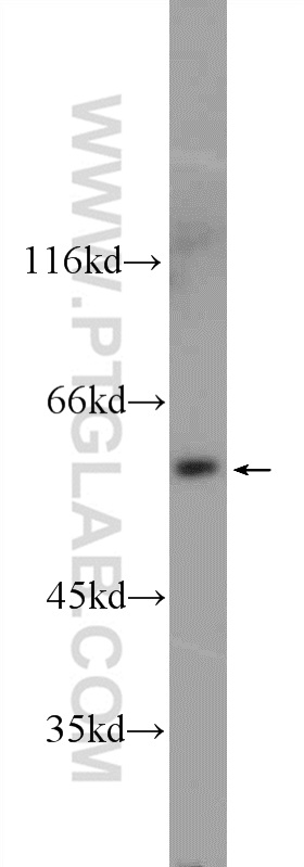 WB analysis of MDA-MB-453s using 25262-1-AP