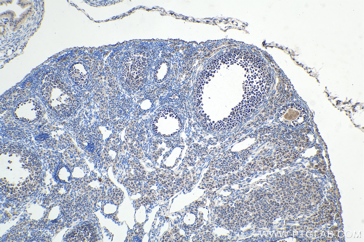 IHC staining of mouse ovary using 18039-1-AP