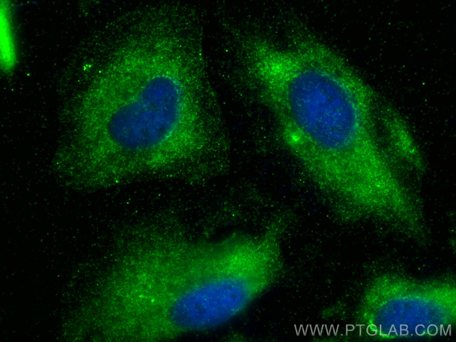 IF Staining of HeLa using 67385-1-Ig (same clone as 67385-1-PBS)