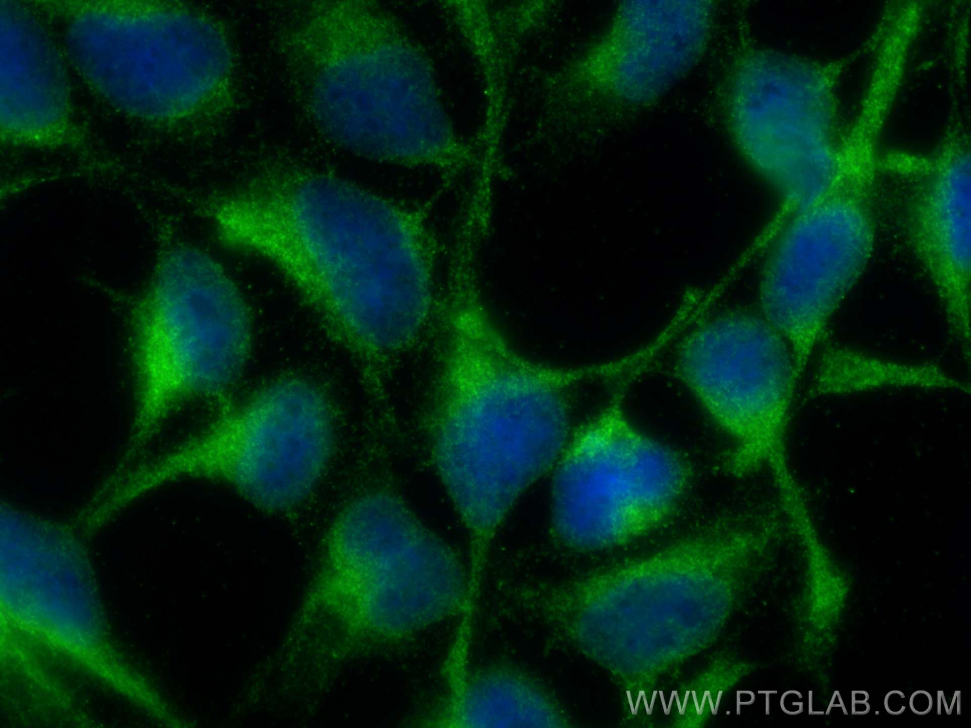 IF Staining of HEK-293 using 25122-1-AP