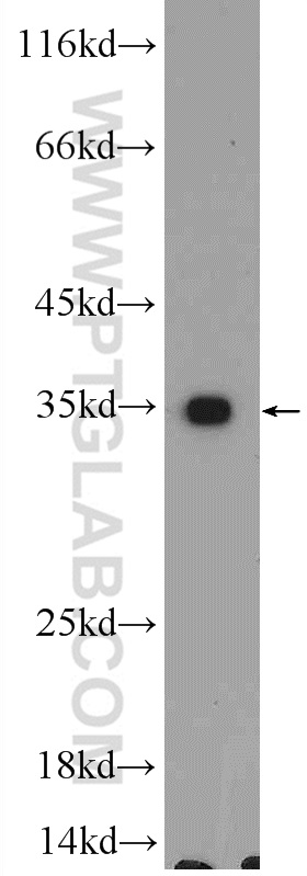 WB analysis of MCF-7 using 25122-1-AP