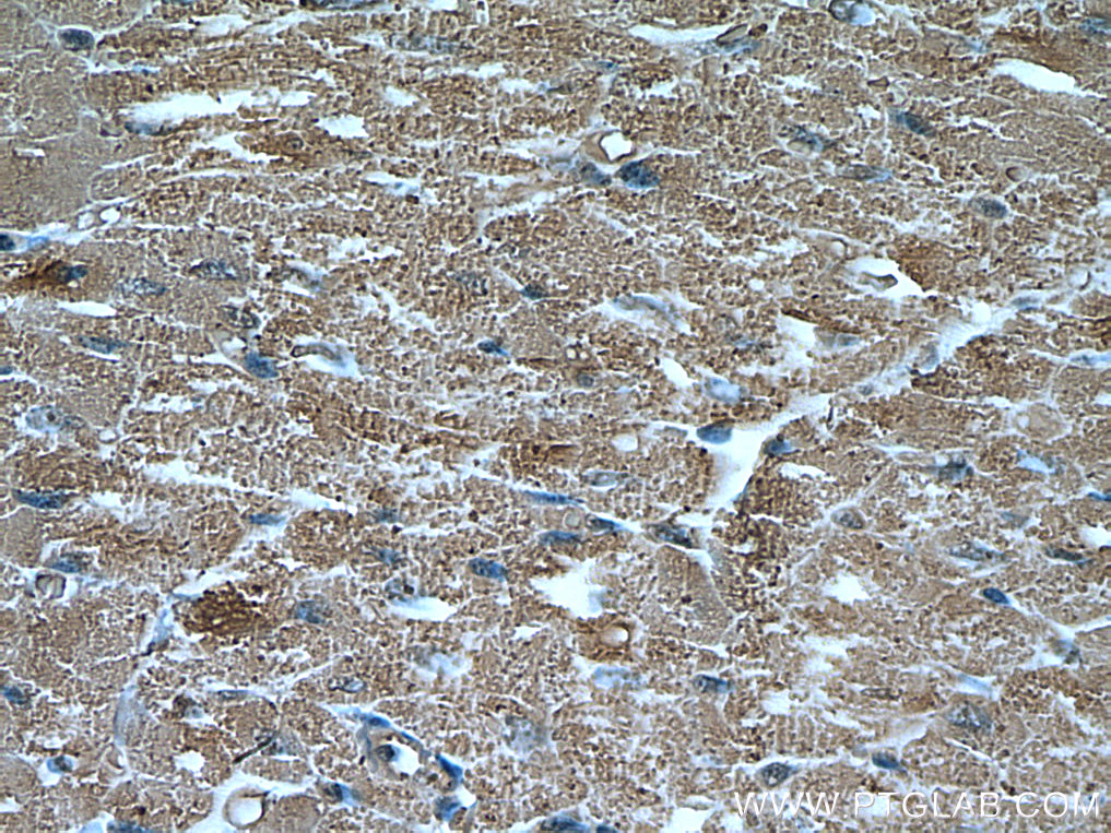 IHC staining of human heart using 66993-1-Ig