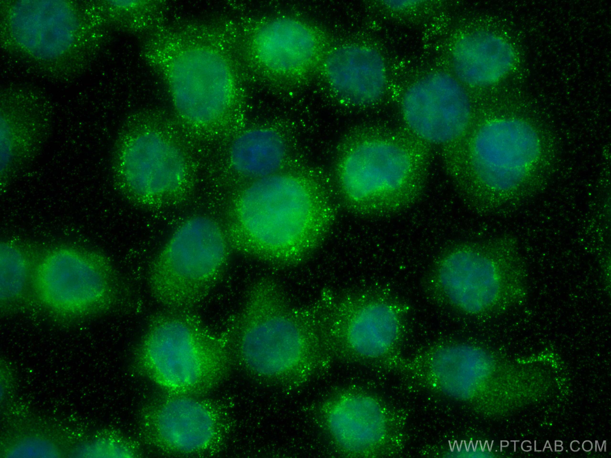 IF Staining of THP-1 using 15823-1-AP