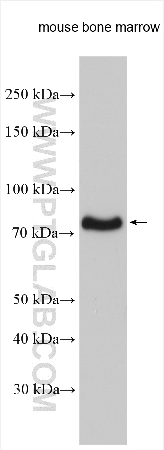 WB analysis using 15823-1-AP