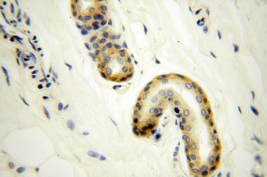 IHC staining of human skin using 17056-1-AP