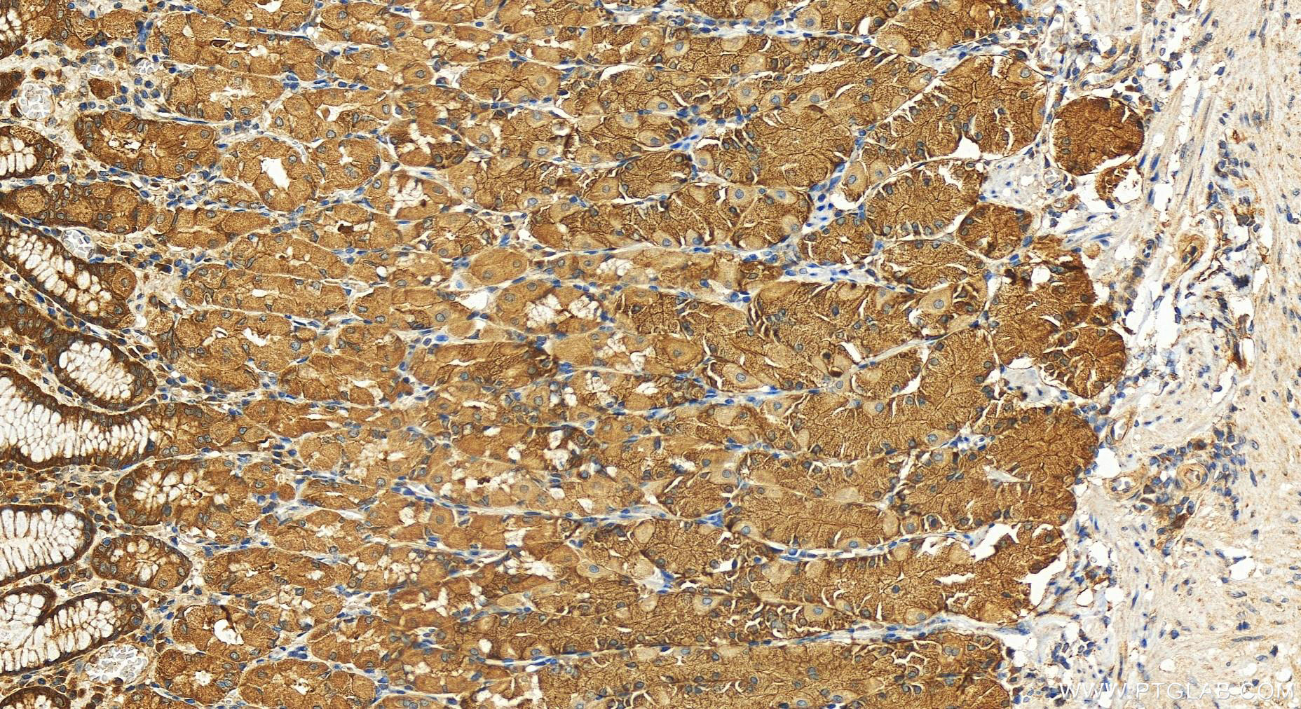 IHC staining of human stomach using 12012-1-AP