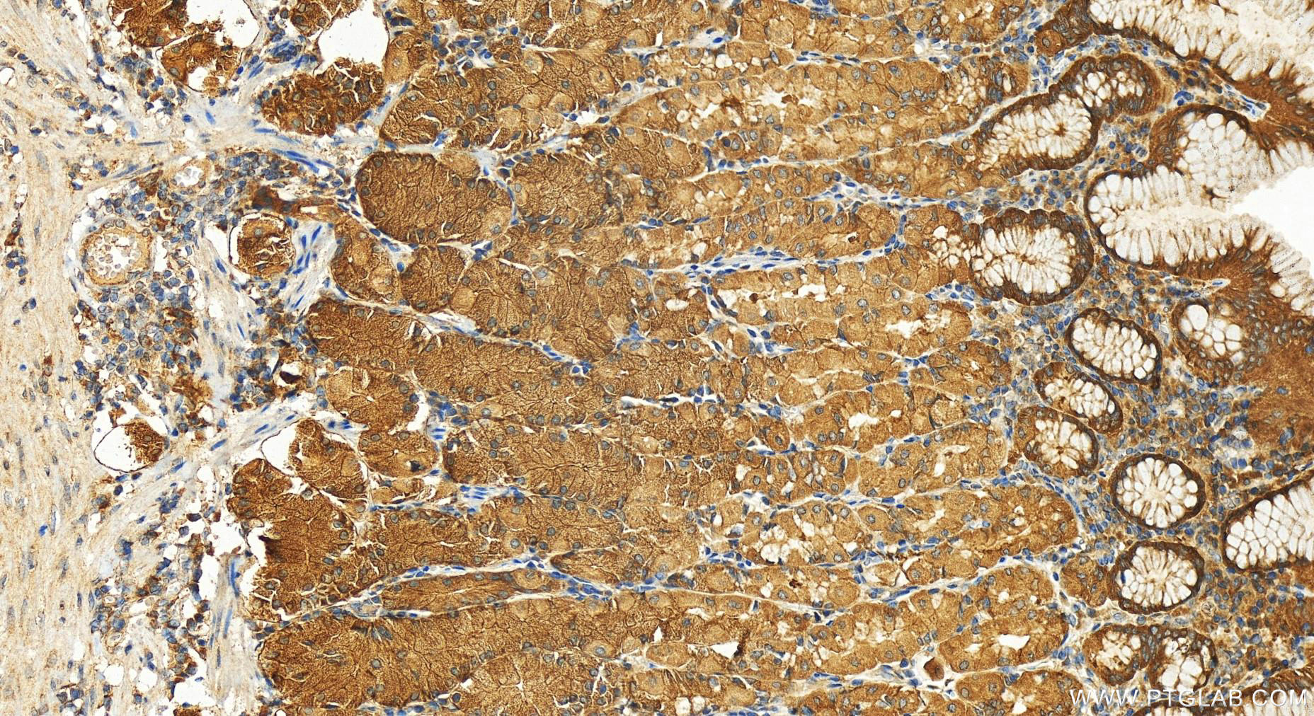 IHC staining of human stomach using 12012-1-AP