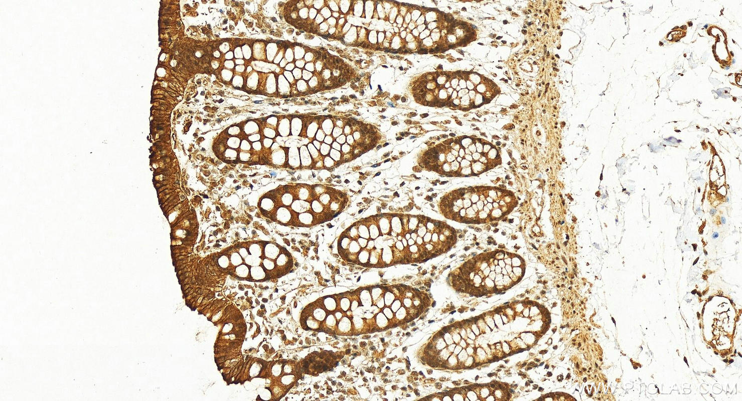 IHC staining of human colon using 15685-1-AP