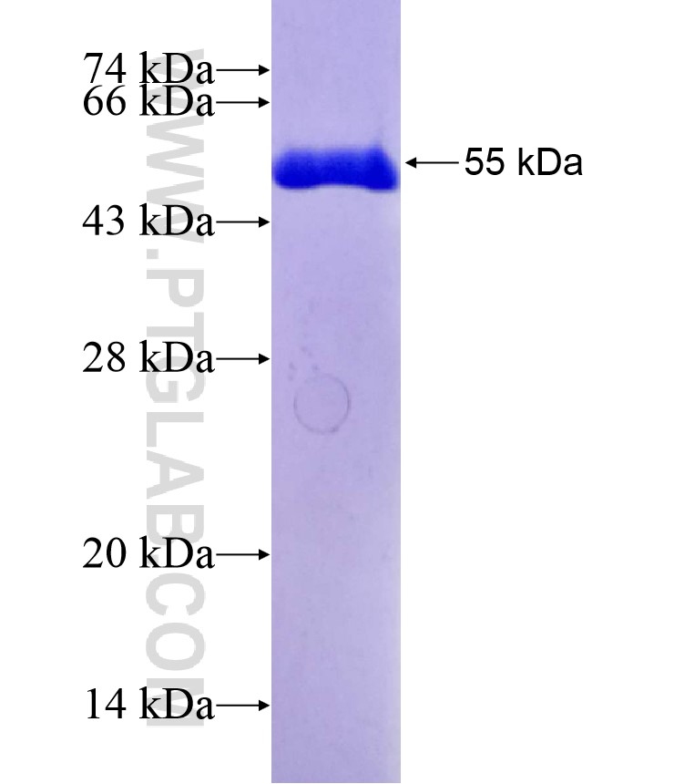 UBE2K fusion protein Ag2415 SDS-PAGE