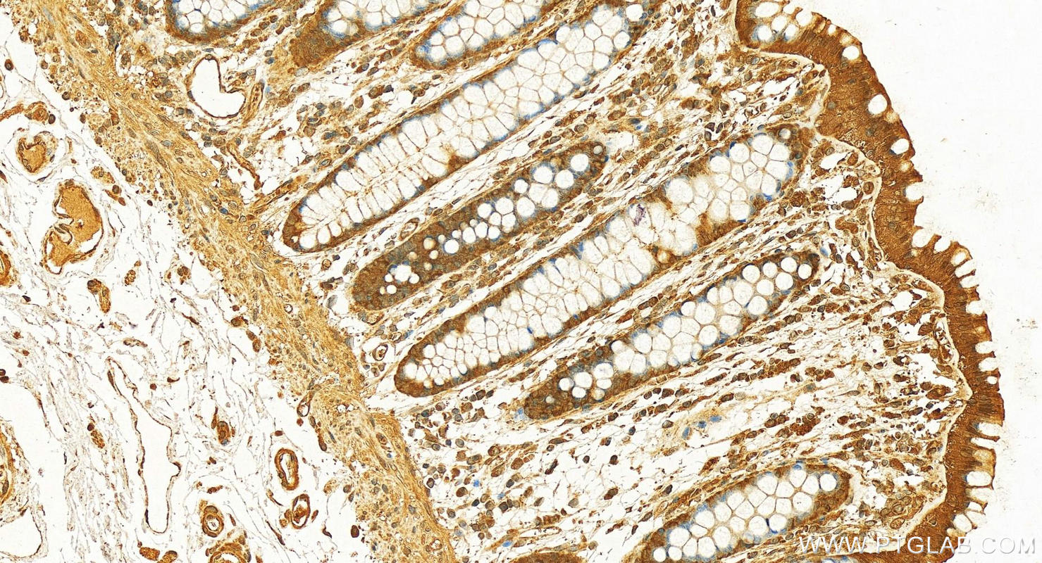 IHC staining of human colon using 10243-1-AP