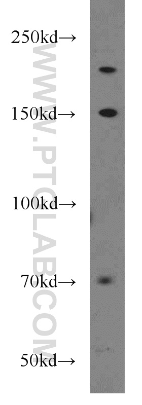 WB analysis of HeLa using 15812-1-AP