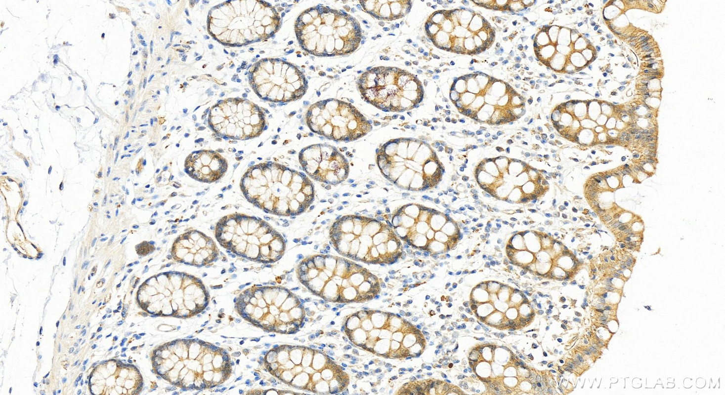 IHC staining of human colon using 10689-1-AP