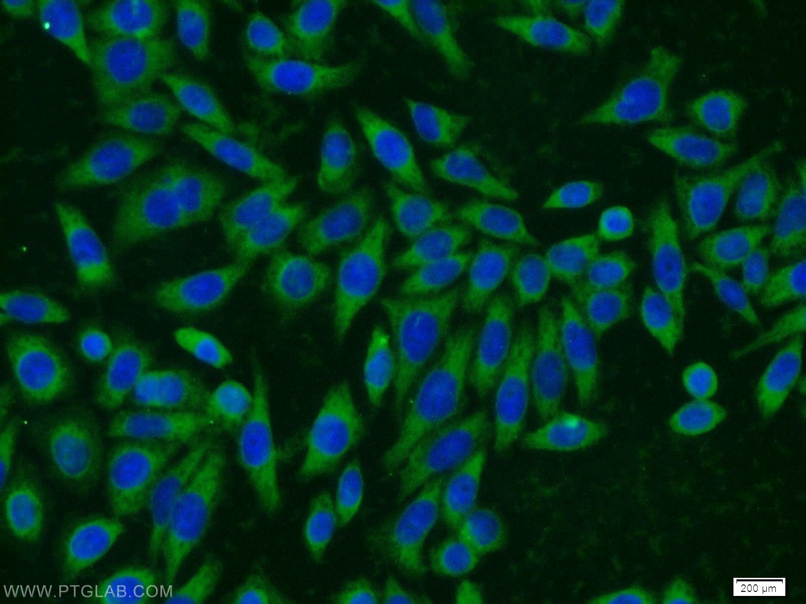 IF Staining of HeLa using 10689-1-AP