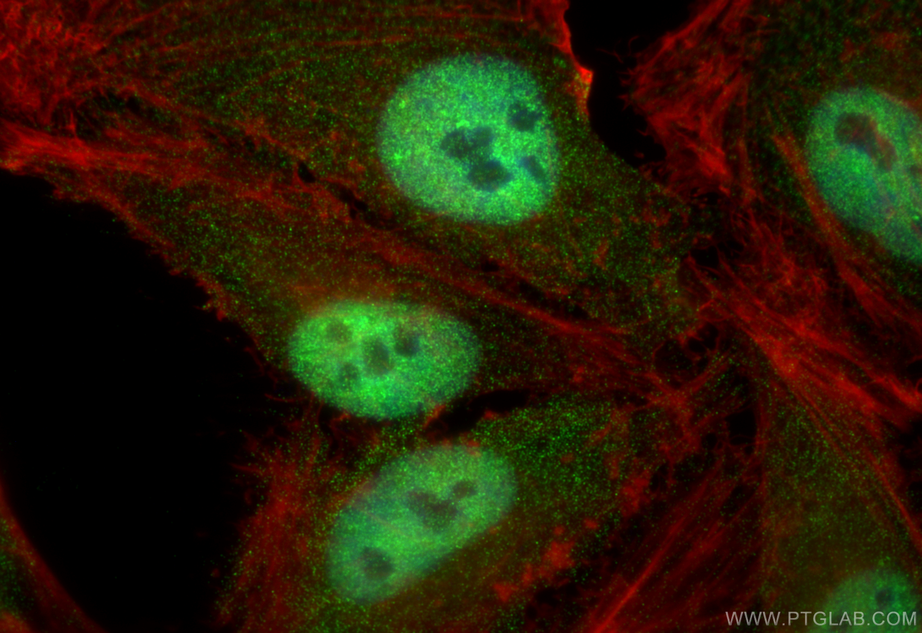 IF Staining of HeLa using 10344-1-AP