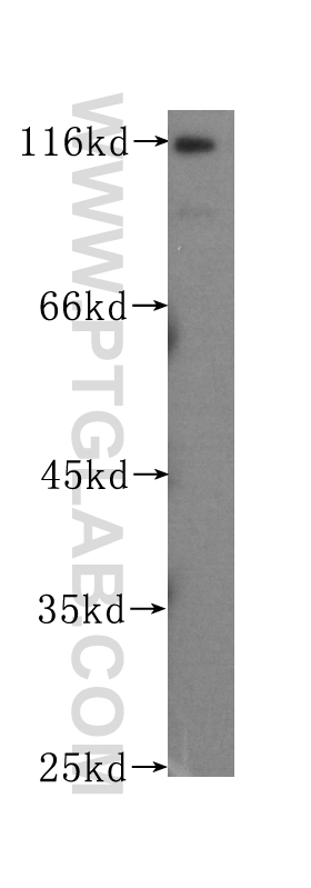 WB analysis of HeLa using 60038-1-Ig