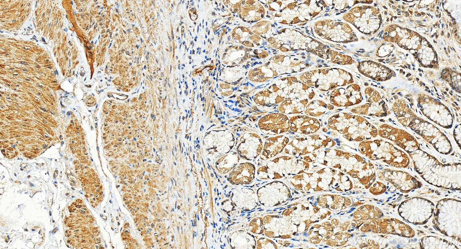 IHC staining of human stomach using 12333-1-AP