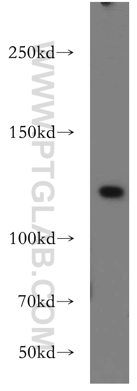 WB analysis of HEK-293 using 21548-1-AP