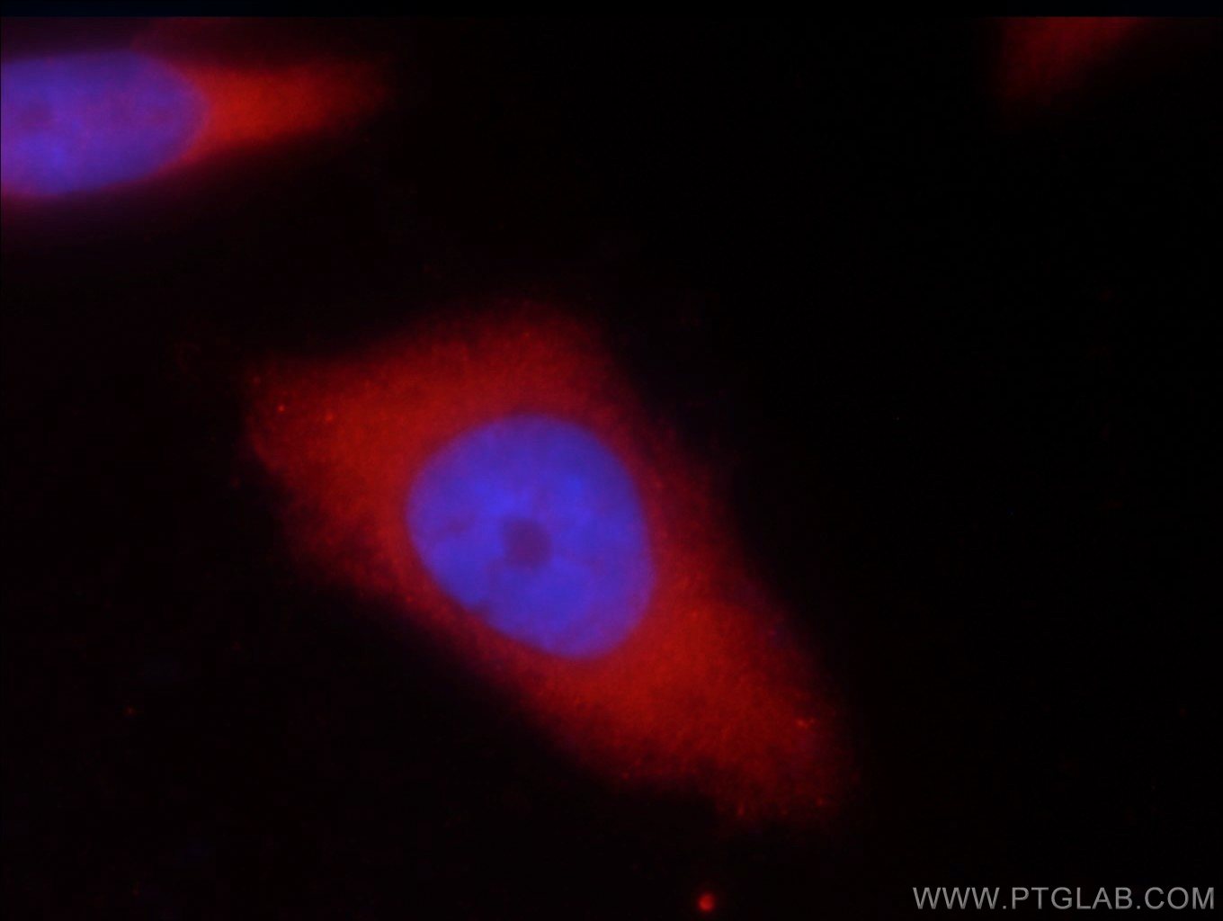 IF Staining of HeLa using 18148-1-AP