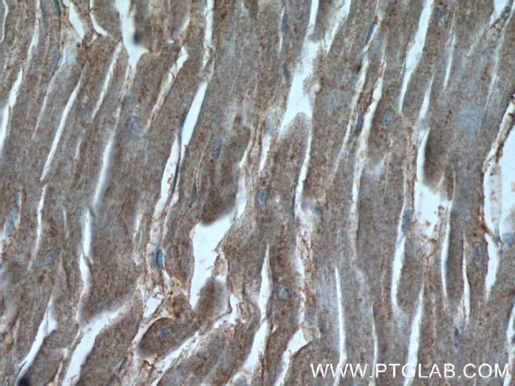 IHC staining of human heart using 18148-1-AP