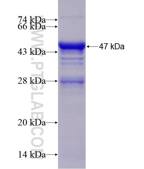 UBN1 fusion protein Ag28501 SDS-PAGE