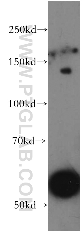 WB analysis of mouse liver using 20363-1-AP