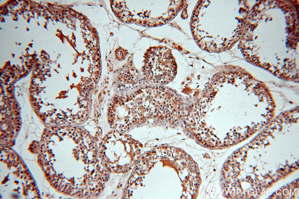 IHC staining of human testis using 18844-1-AP