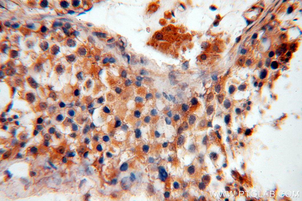 IHC staining of human testis using 18844-1-AP