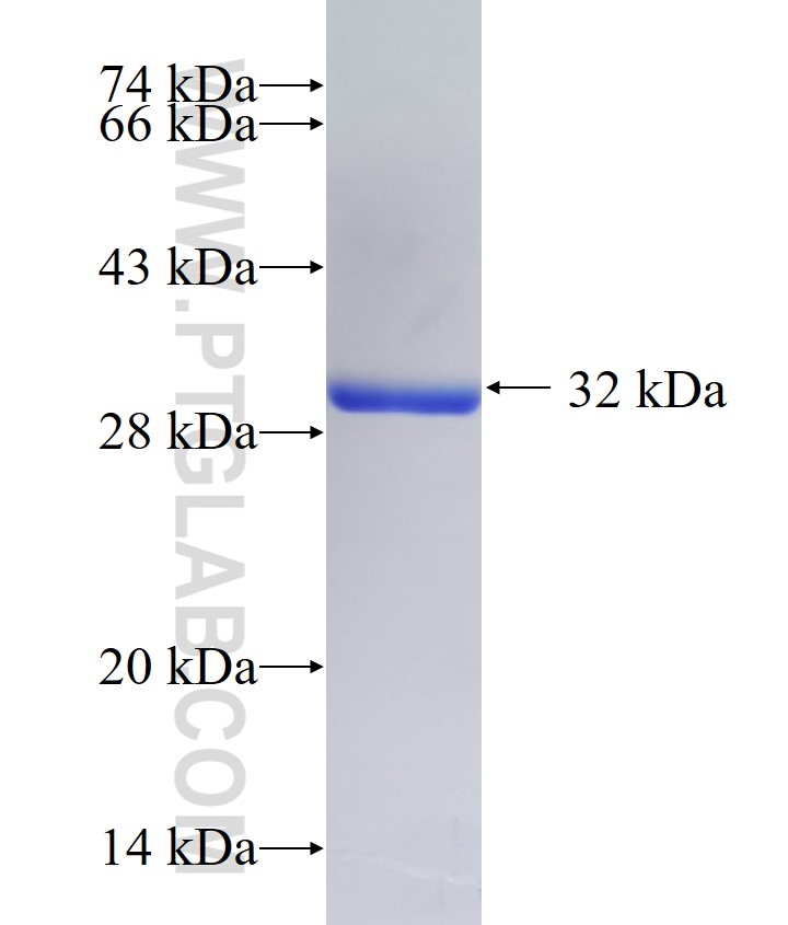 Ubiquilin 1 fusion protein Ag17530 SDS-PAGE