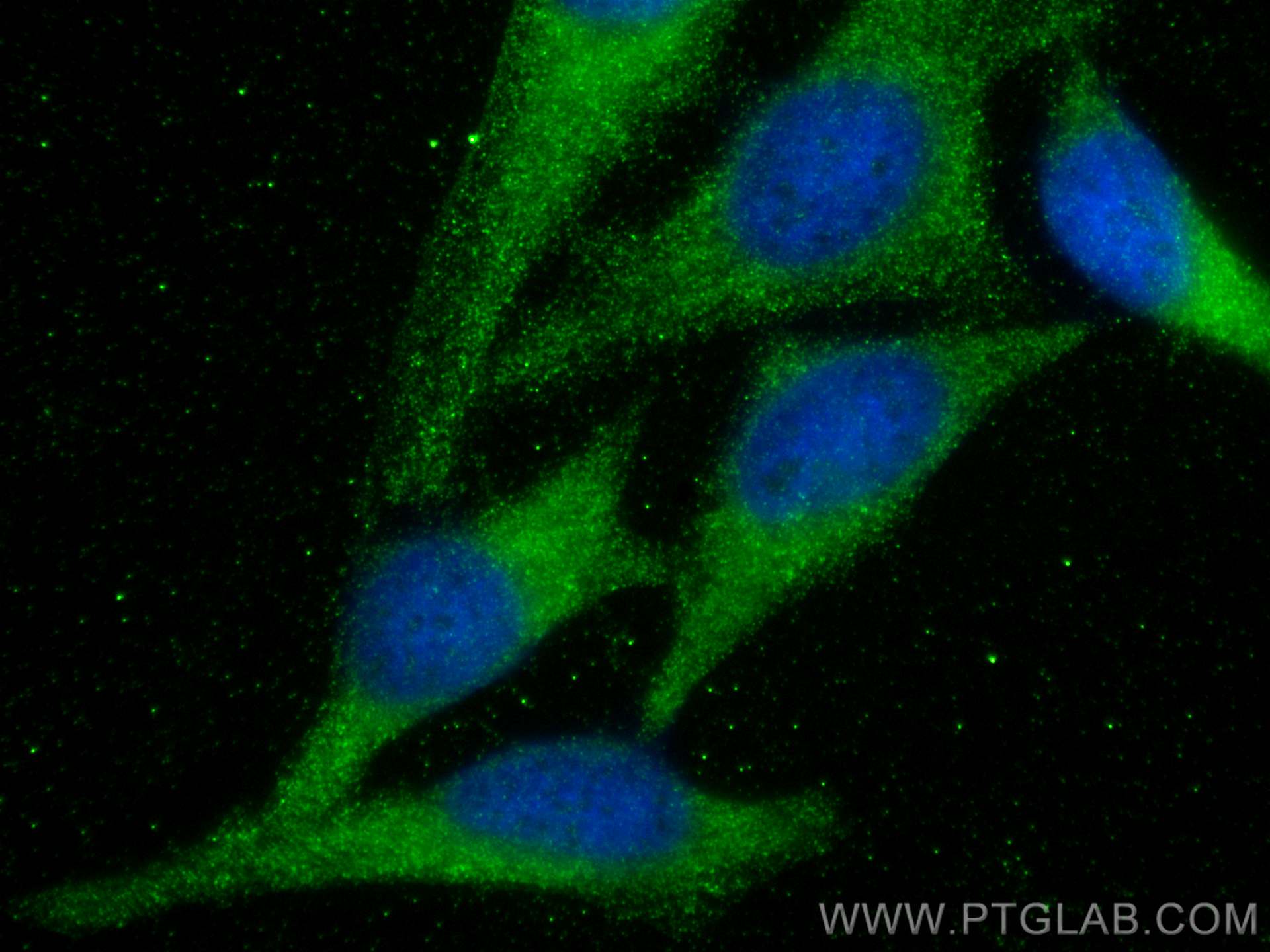 IF Staining of HeLa using 15966-1-AP (same clone as 15966-1-PBS)