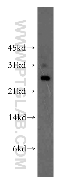 WB analysis of human liver using 13172-1-AP