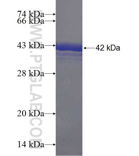 UBXN11 fusion protein Ag20398 SDS-PAGE