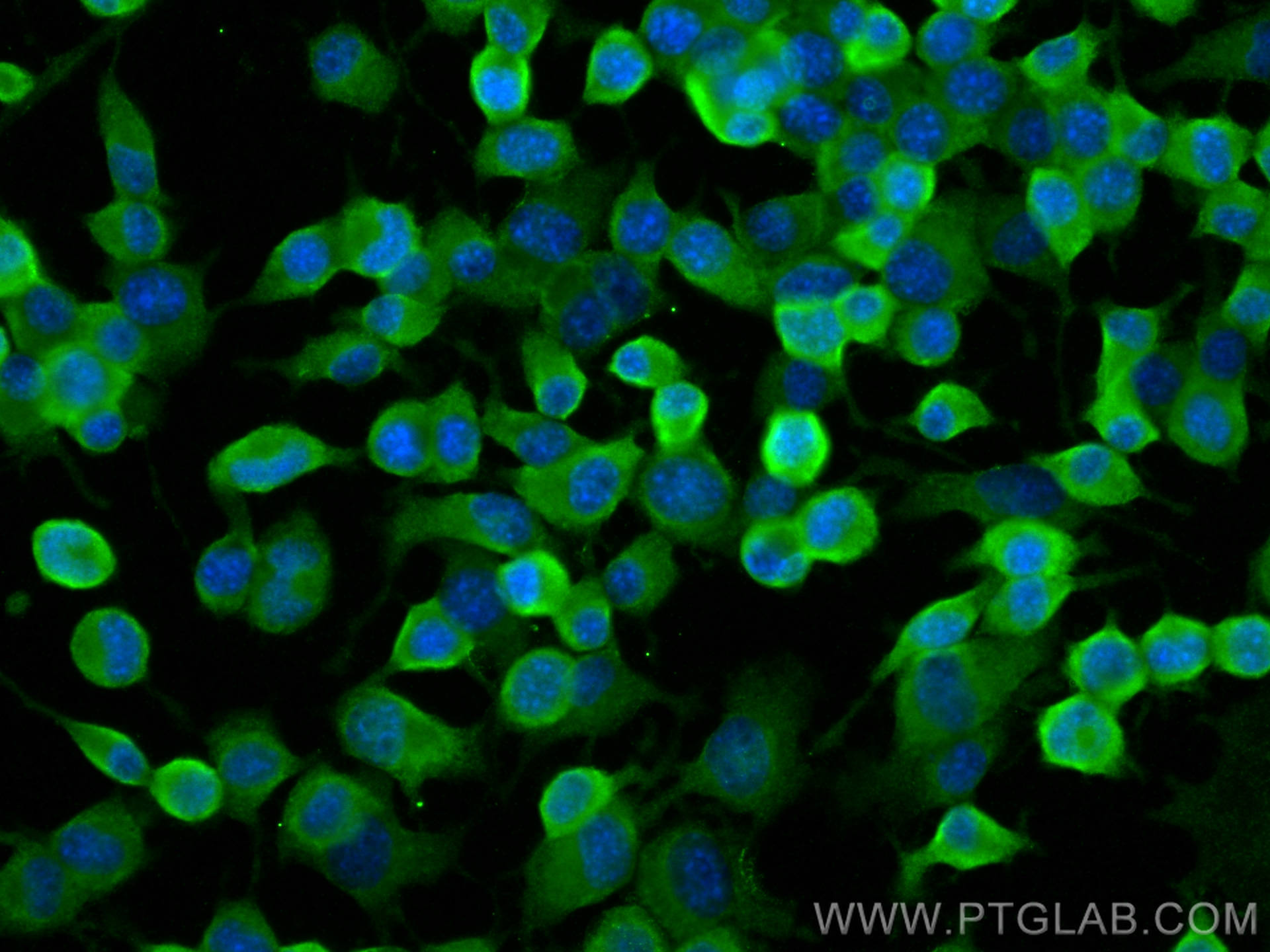 IF Staining of Neuro-2a using 25141-1-AP