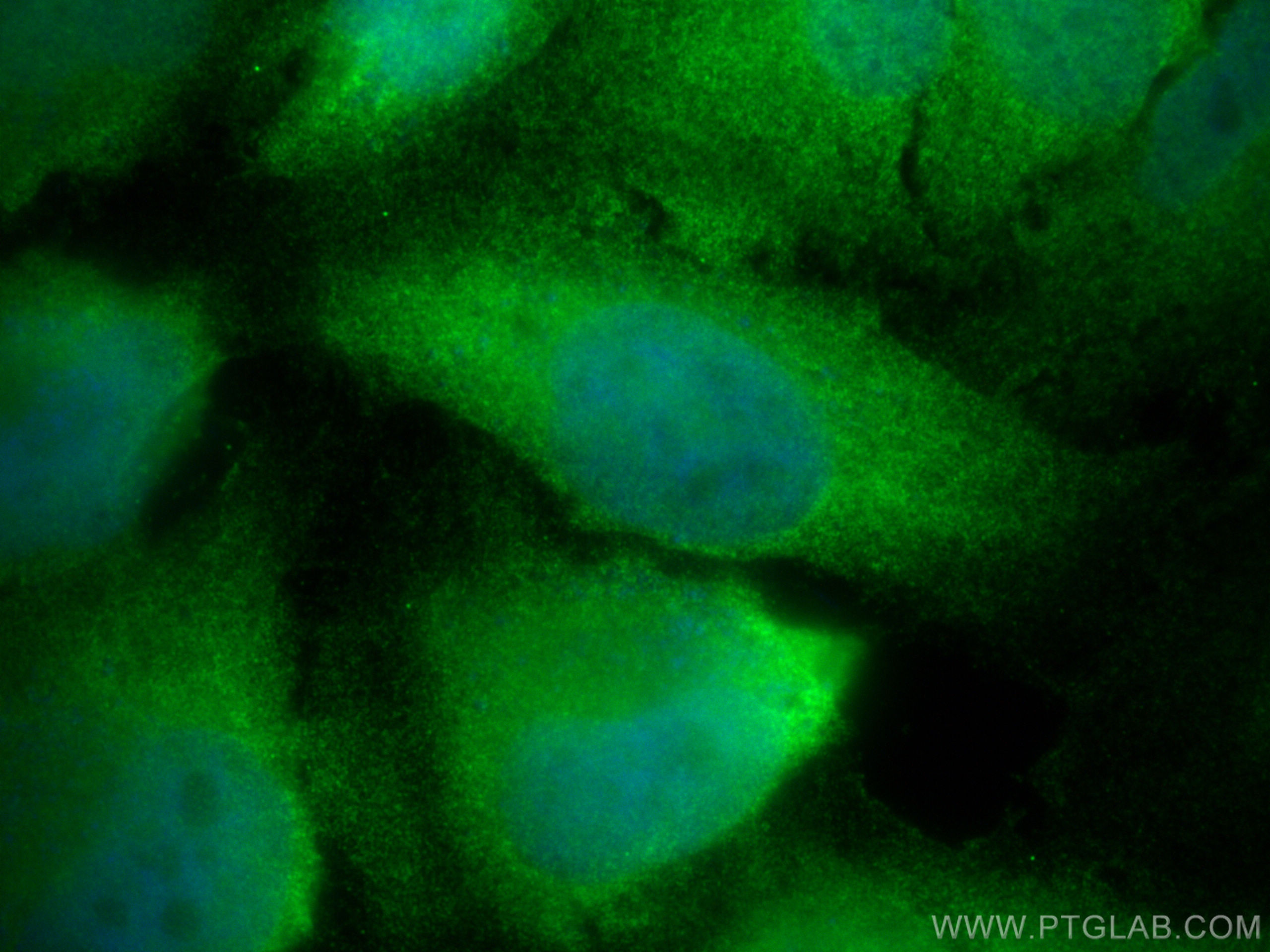 IF Staining of HeLa using 14706-1-AP