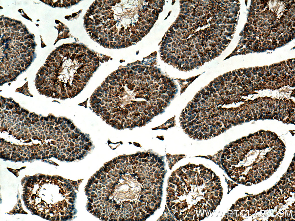 IHC staining of mouse testis using 14706-1-AP