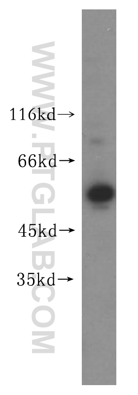 WB analysis of PC-3 using 14706-1-AP