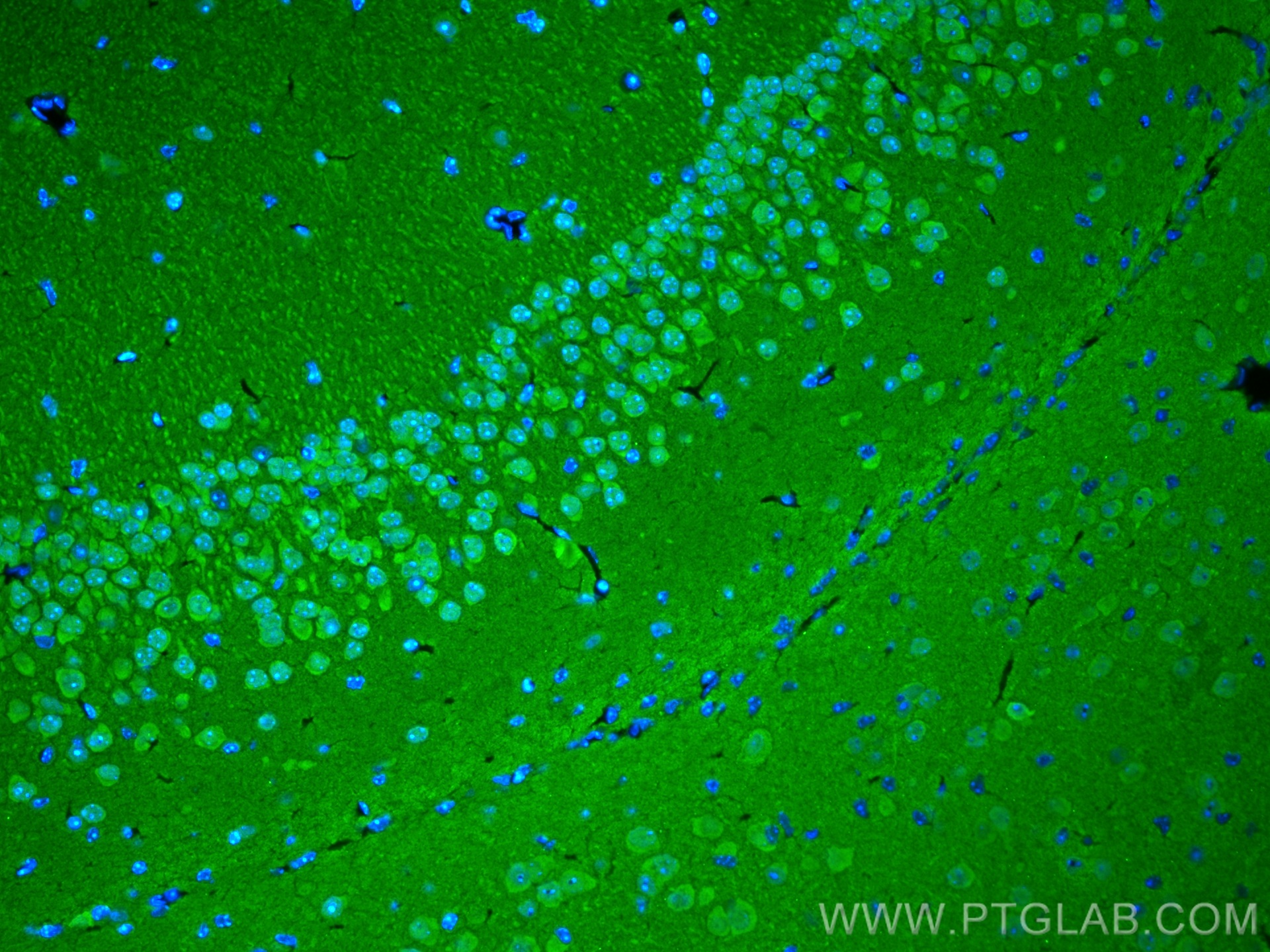 IF Staining of mouse brain using 14730-1-AP