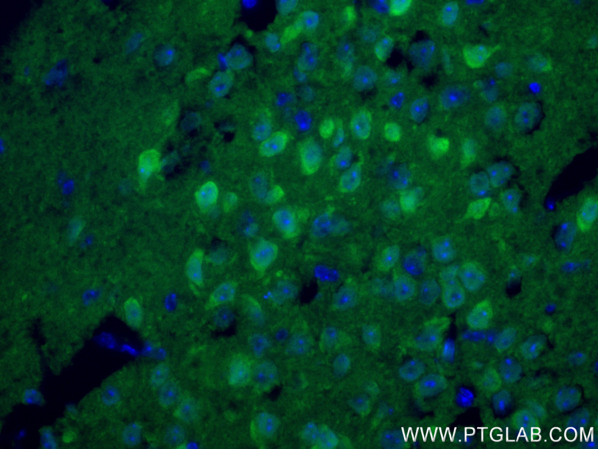 IF Staining of mouse brain using 84154-4-RR