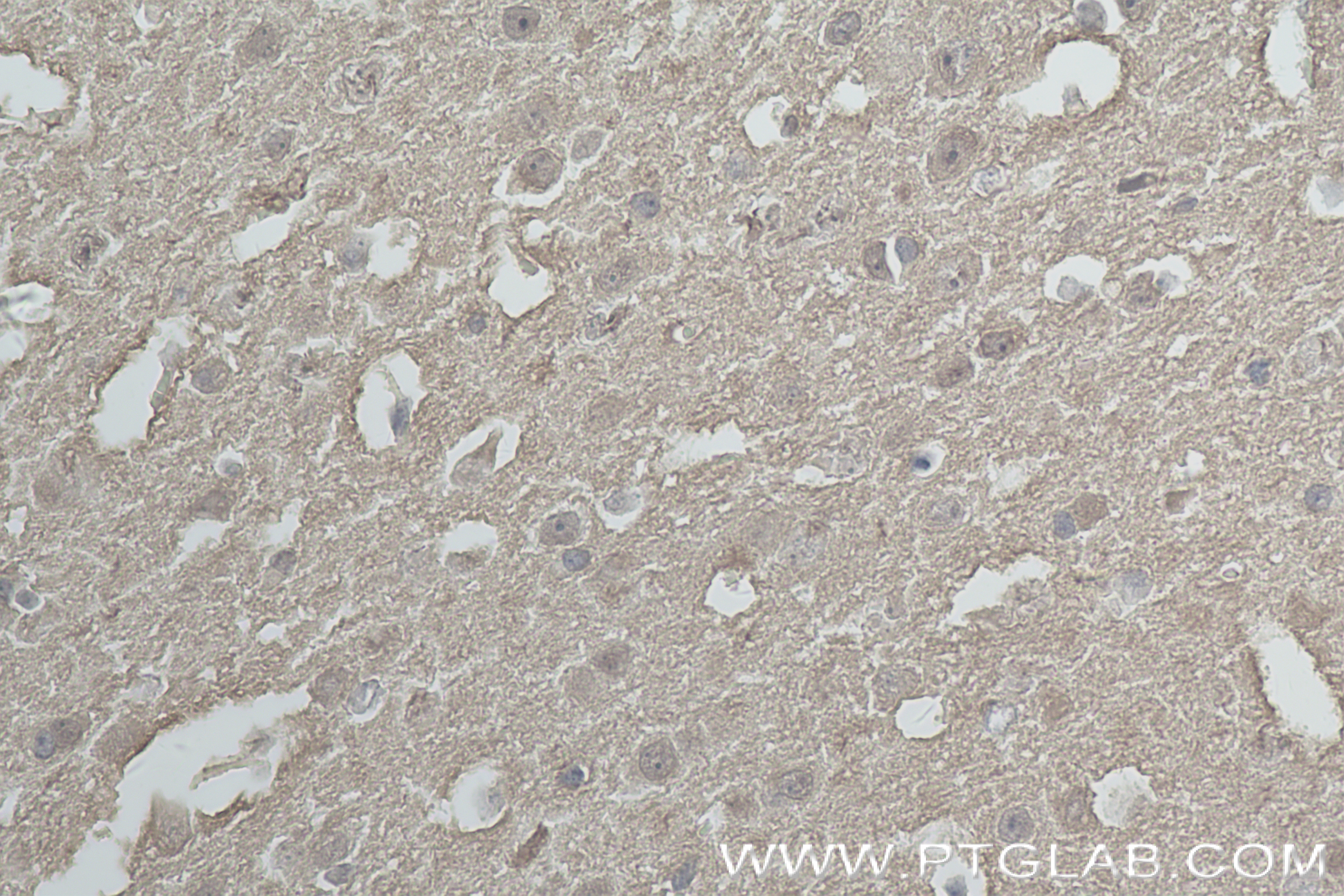 IHC staining of mouse brain using 84154-4-RR