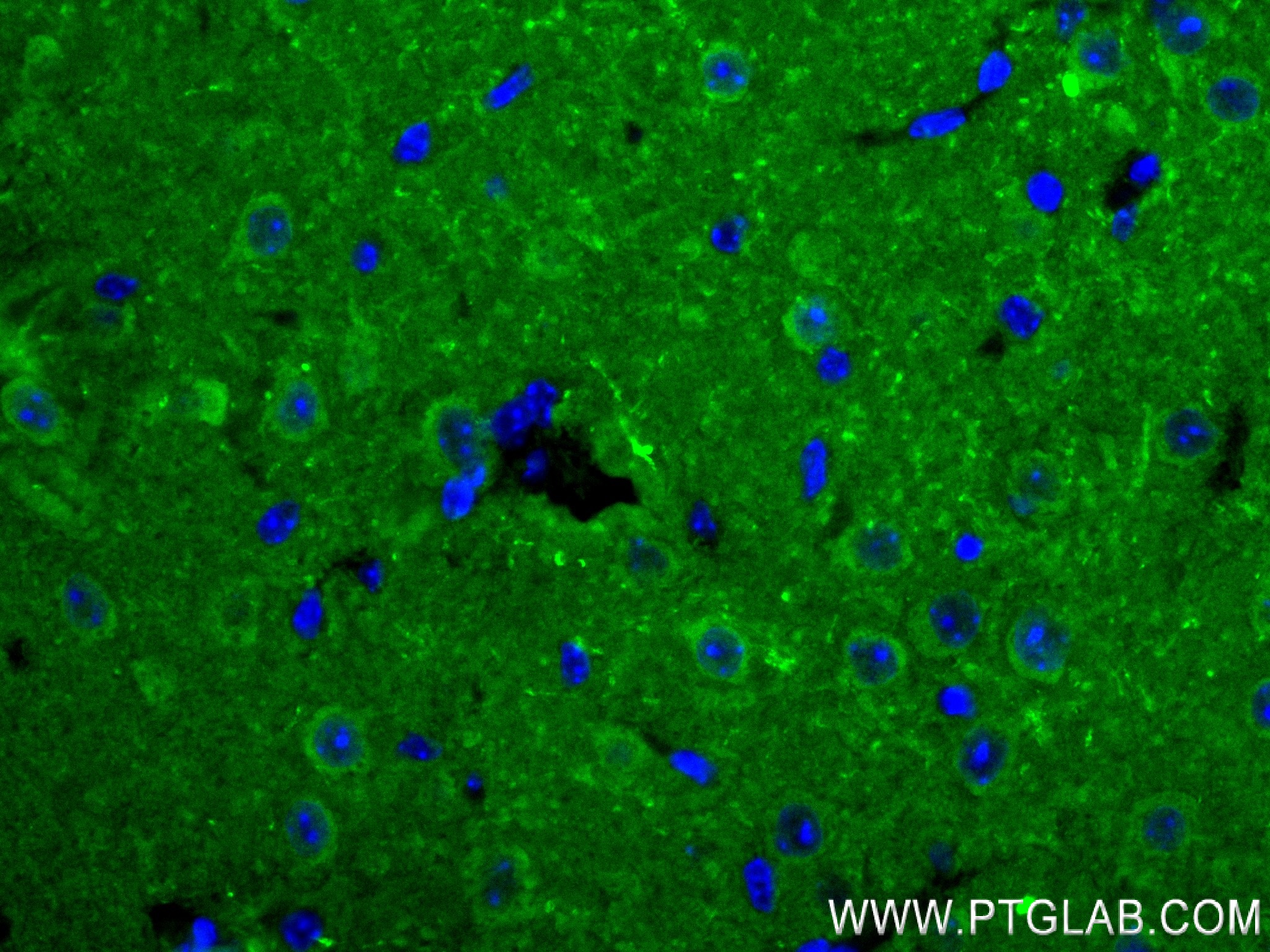 IF Staining of mouse brain using 84154-5-RR (same clone as 84154-5-PBS)