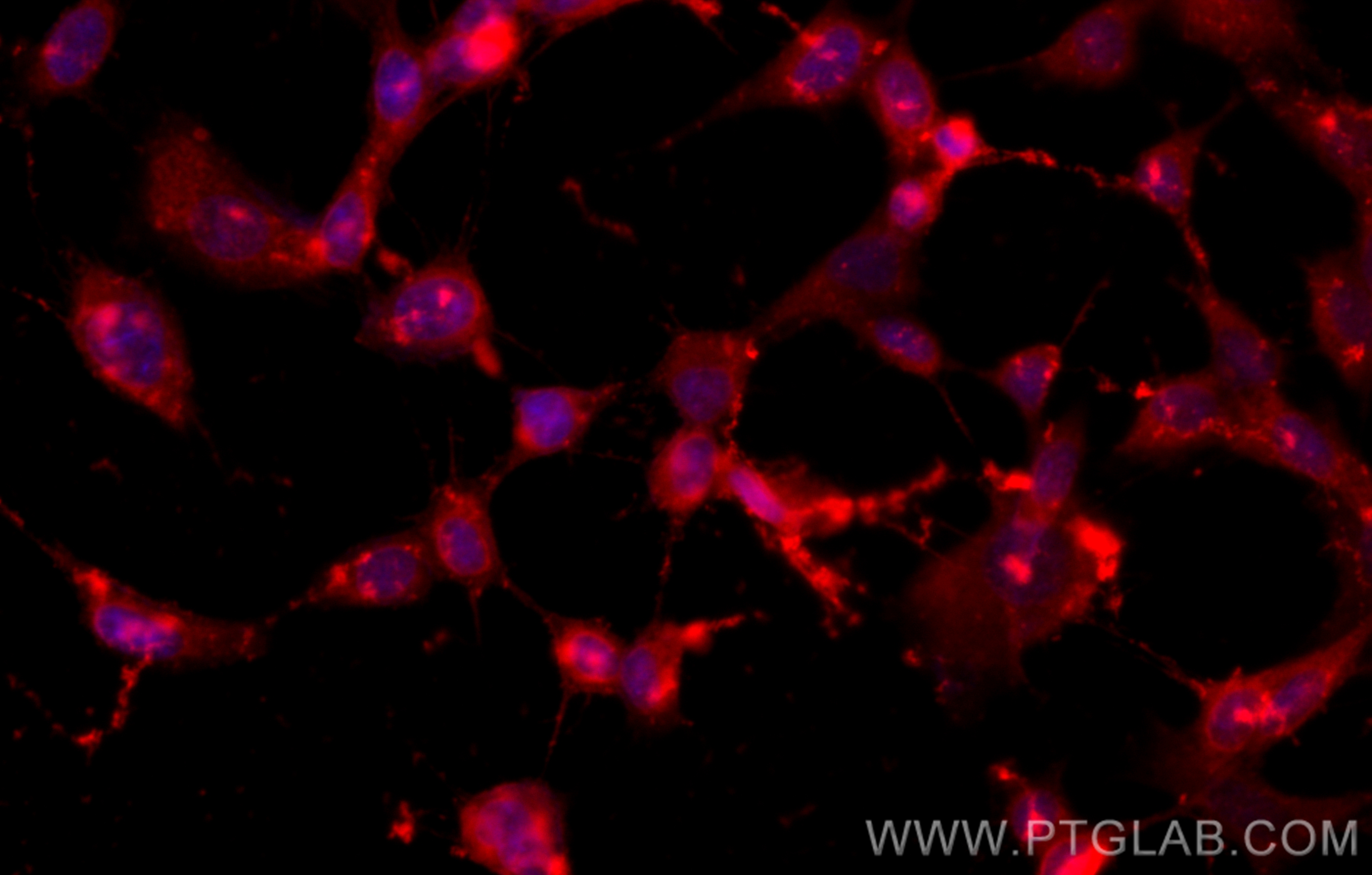 IF Staining of SH-SY5Y using CL594-66230