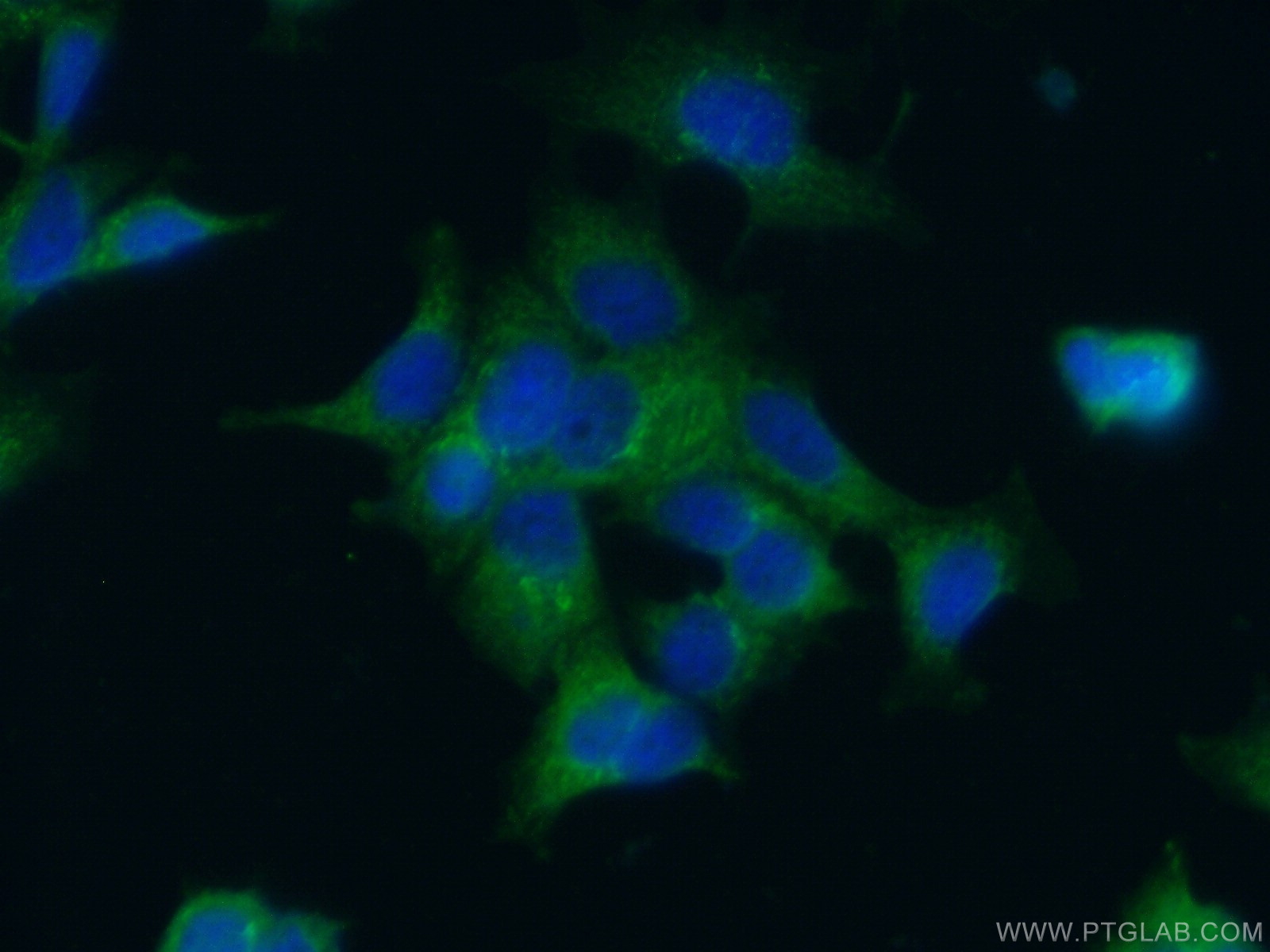 IF Staining of MCF-7 using 17830-1-AP