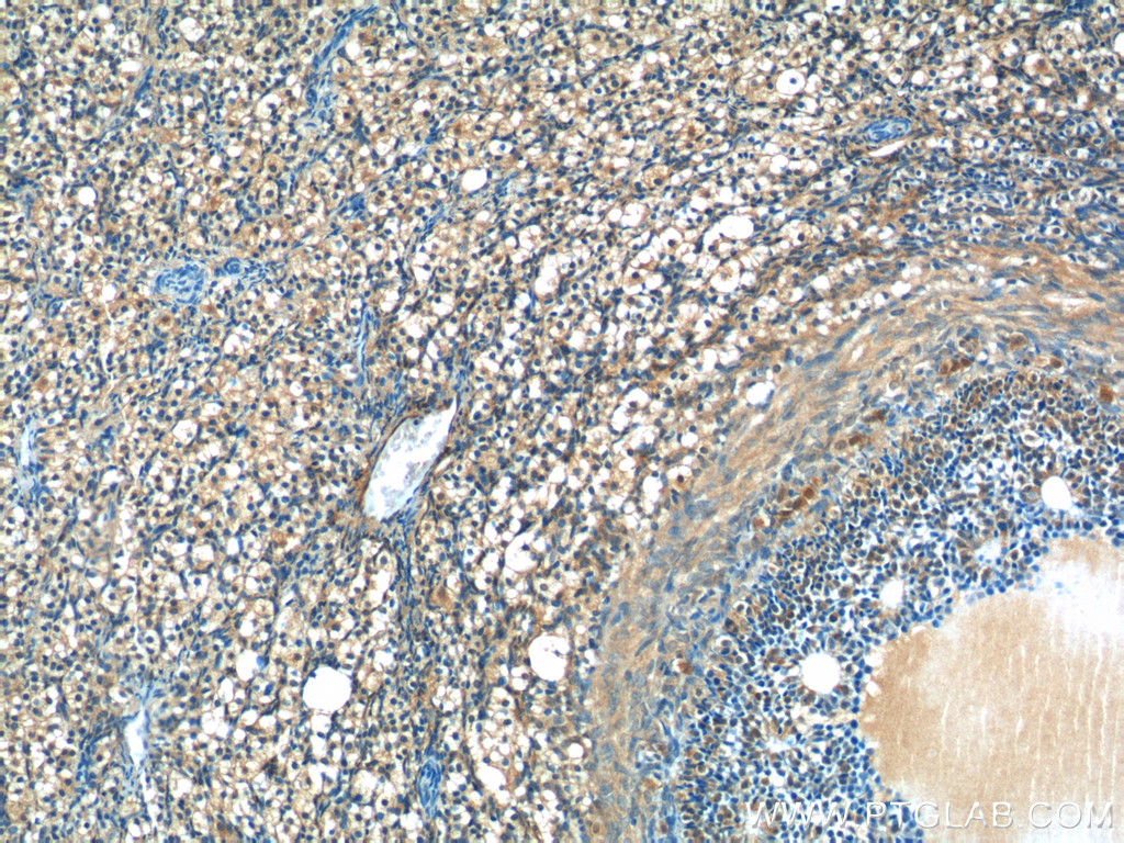 IHC staining of human ovary using 17830-1-AP