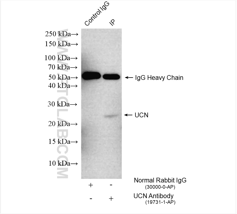 IP experiment of mouse kidney using 19731-1-AP