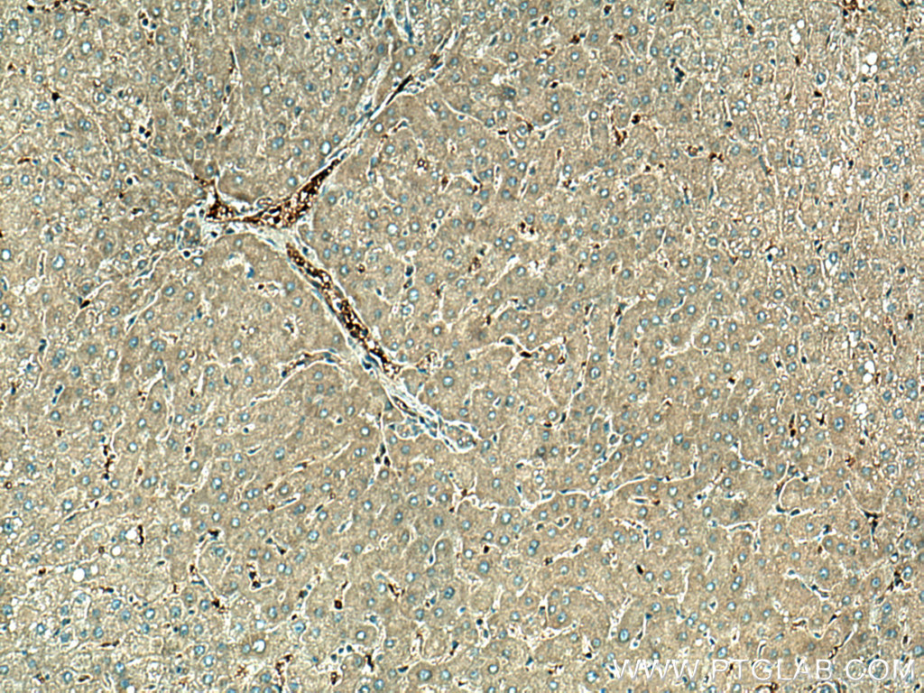 IHC staining of human liver using 15783-1-AP